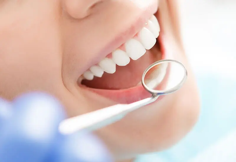 変色しにくく、美しさが長持ち