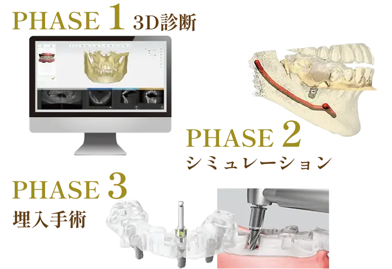 オステムワンガイド