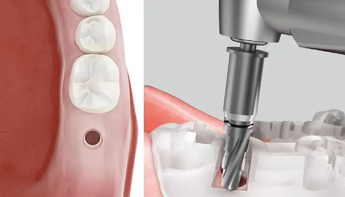 負担を抑えた低侵襲治療