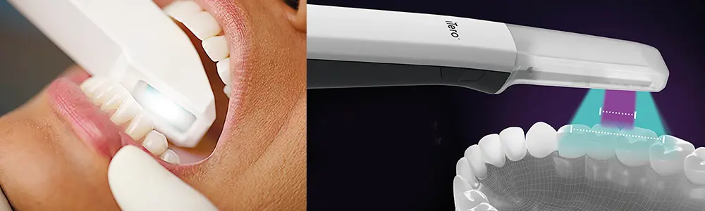 口腔内スキャナー