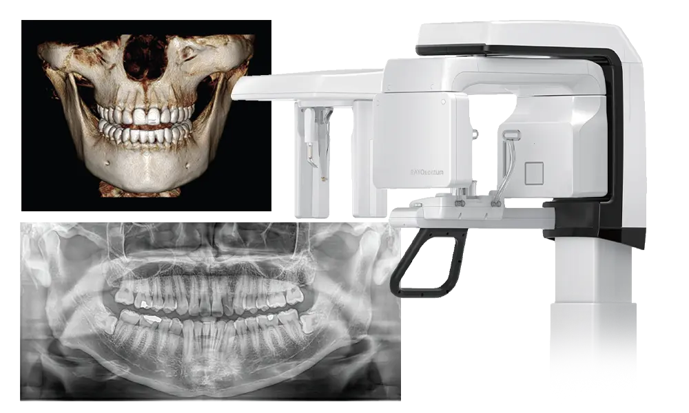 歯科用CT・デジタルレントゲン