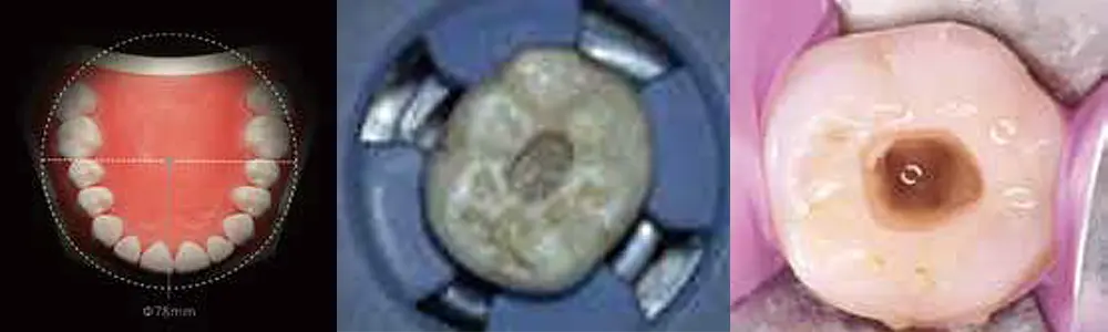 マイクロスコープ