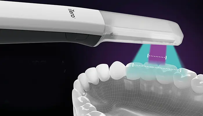 高精度で採り直しがほぼ不要