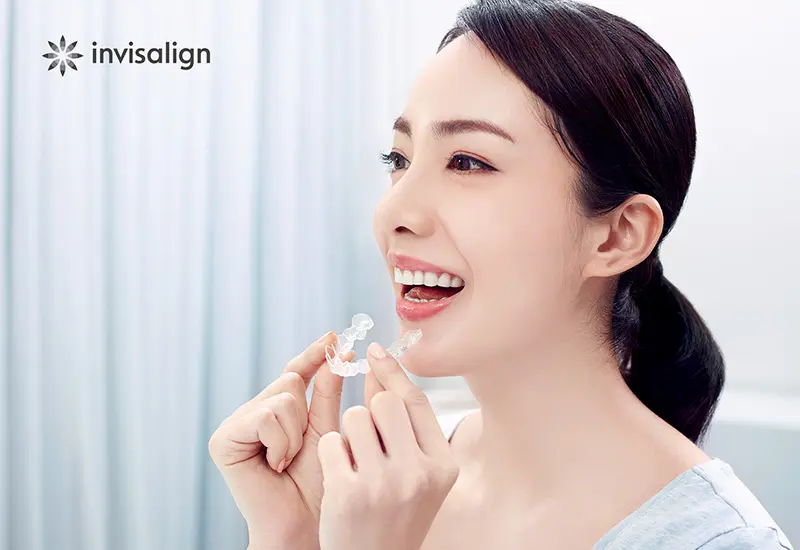 マウスピース矯正