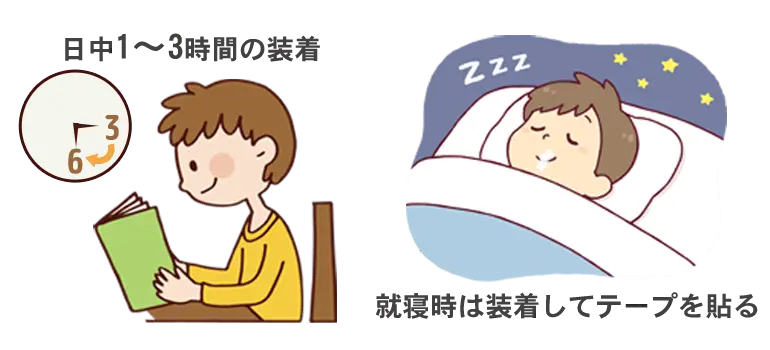 装着のポイント