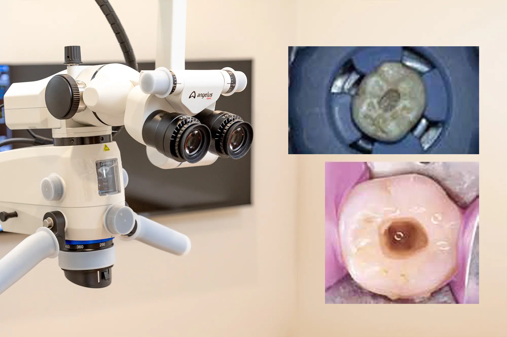 マイクロスコープ