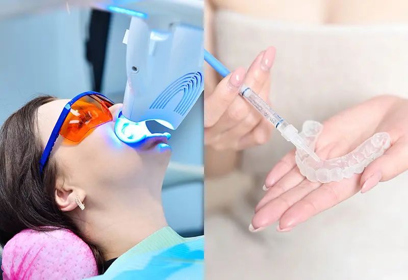 デュアルホワイトニング